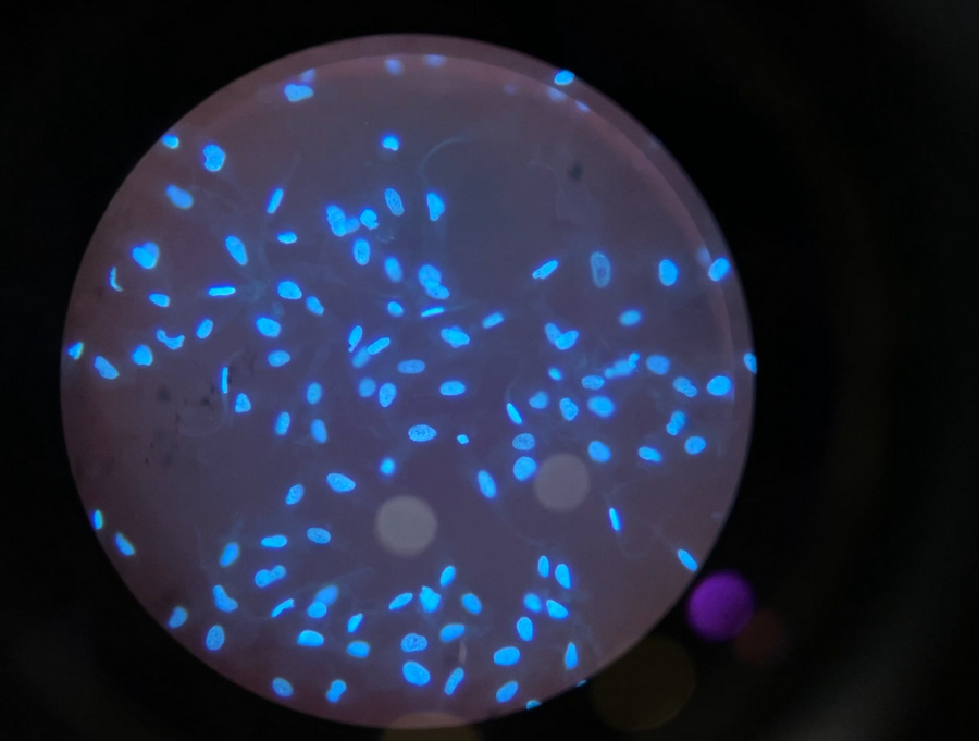 BG_Fluo_09.jpg